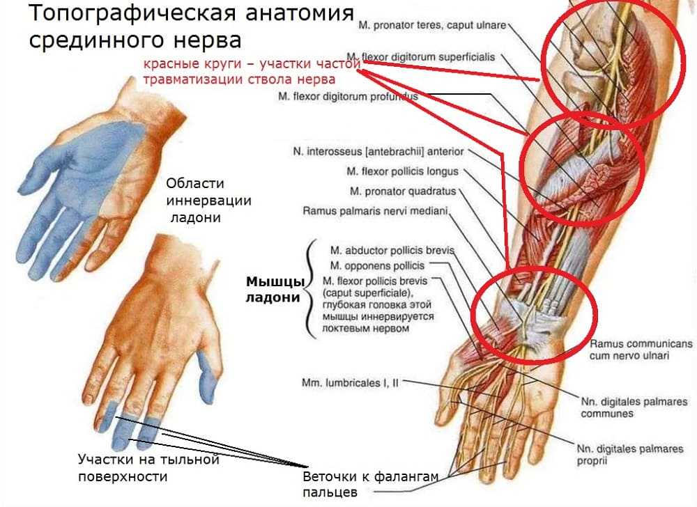 Пальцы колет иголками. Туннельный синдром срединного нерва. Срединный нерв руки анатомия. Симптомы туннельного синдрома запястного канала. Синдром запястного канала и онемение пальцев.