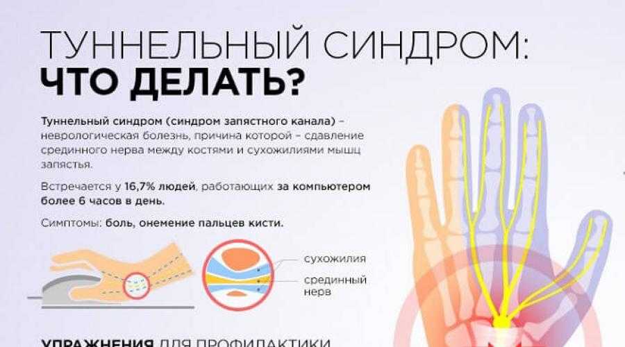 Сильно болят пальцы рук что делать. . Кистевой туннельный синдром (карпальный синдром). Туннельный синдром запястья кисти мкб 10. Туннельный синдром лучезапястного сустава мкб 10. Туннельный синдром подушечка.